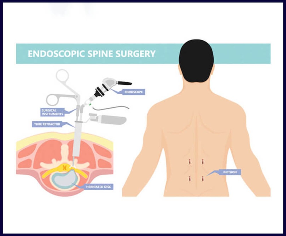 HHG - Πουλλάς HHG - Πουλλάς