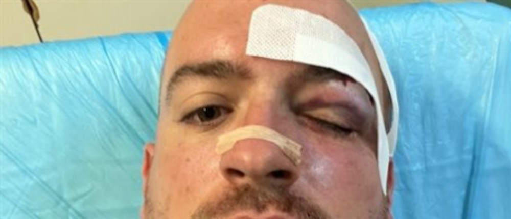 Τραυματιας εθελοντης στην Παρνηθα Τραυματιας εθελοντης στην Παρνηθα