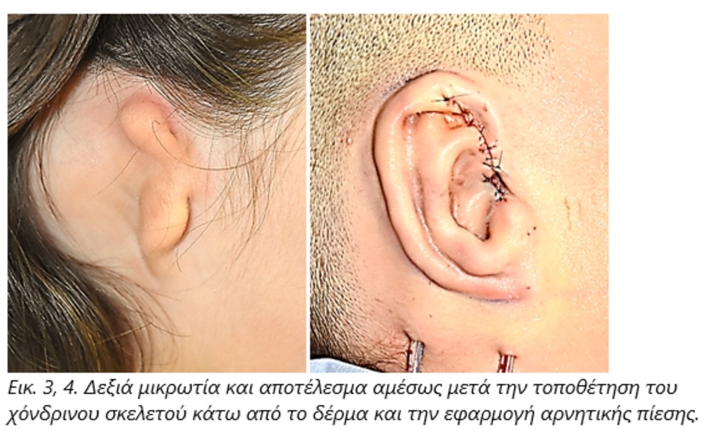 HHG - ΚΑΞΙΡΑ HHG - ΚΑΞΙΡΑ