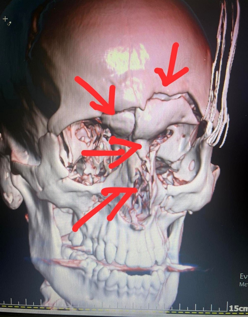 Ελληνοκαναδός - Ακτινογραφία Ελληνοκαναδός - Ακτινογραφία