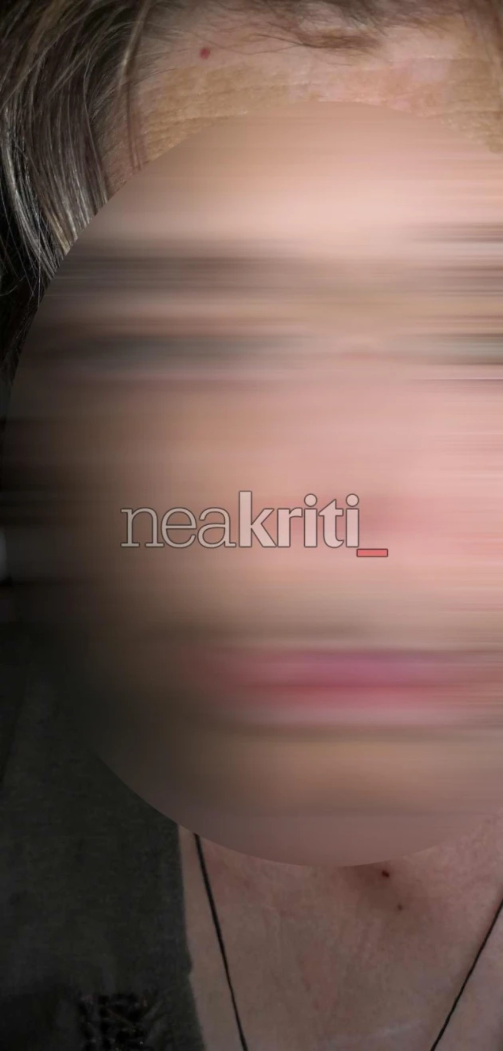 Κρήτη - ΑμεΑ - Ξυλοδαρμός