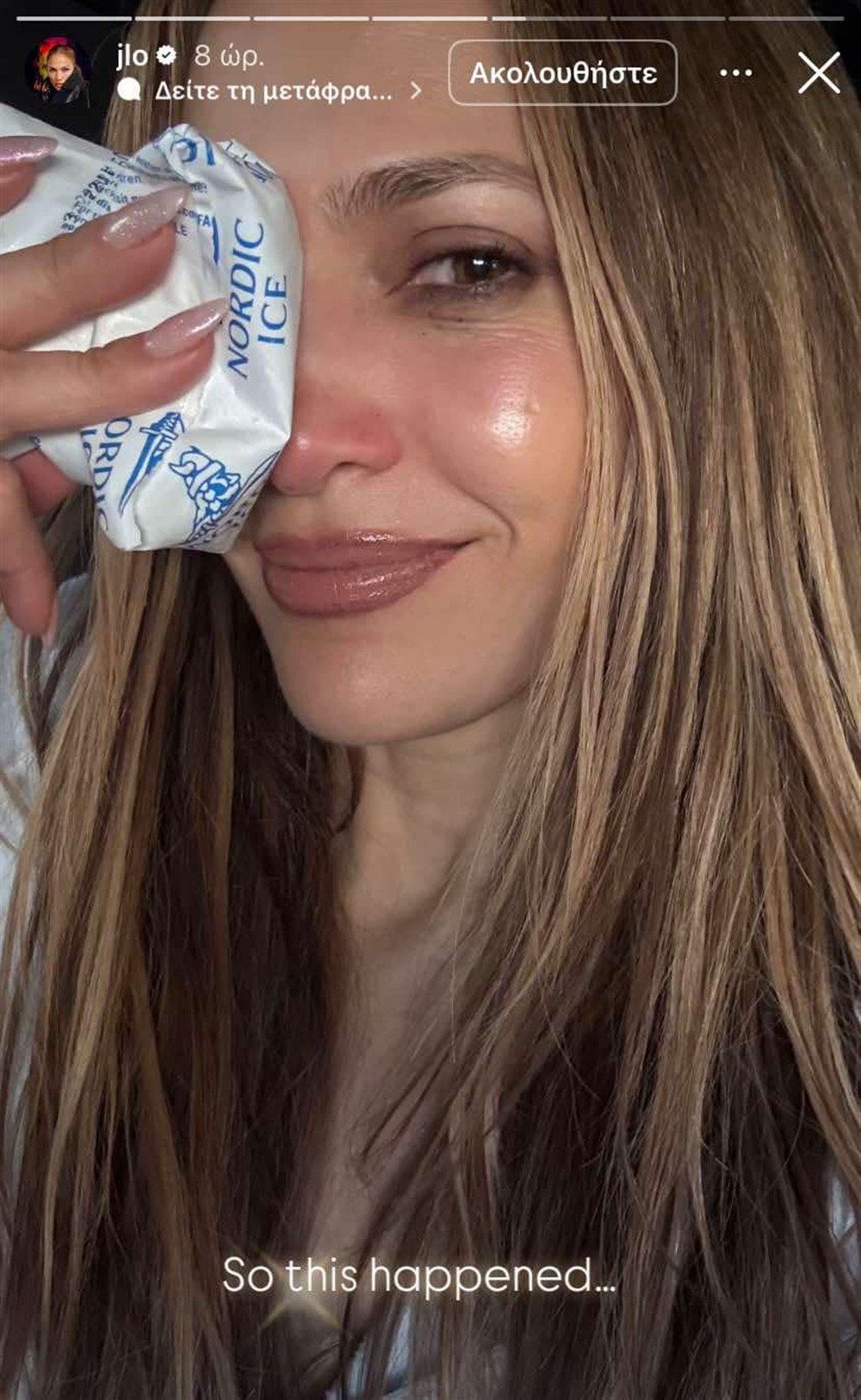 λοπεζ λοπεζ