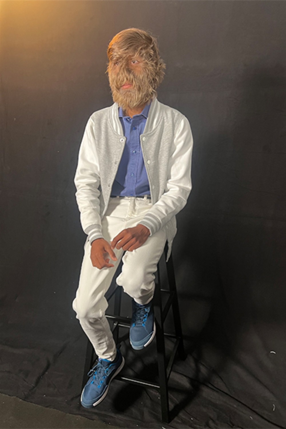 Ρεκόρ Γκίνες - Τριχωτό πρόσωπο - Lalit Patidar Ρεκόρ Γκίνες - Τριχωτό πρόσωπο - Lalit Patidar