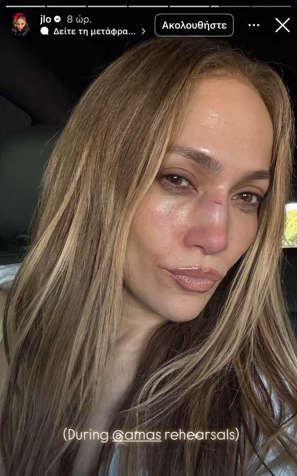 λοπεζ λοπεζ