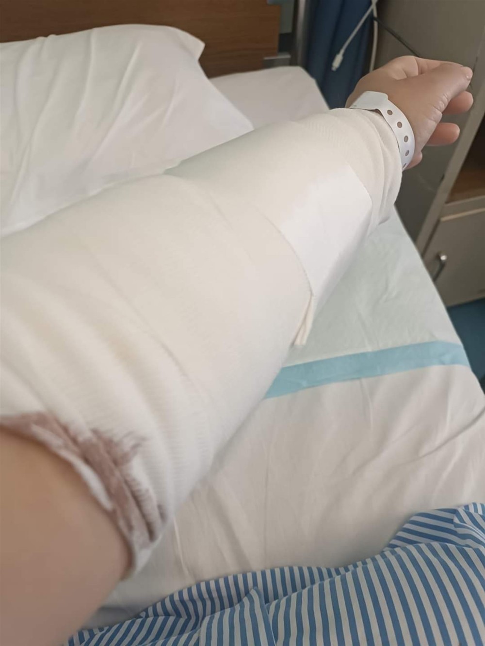 Χαλκιδική - δάγκωμα Χαλκιδική - δάγκωμα