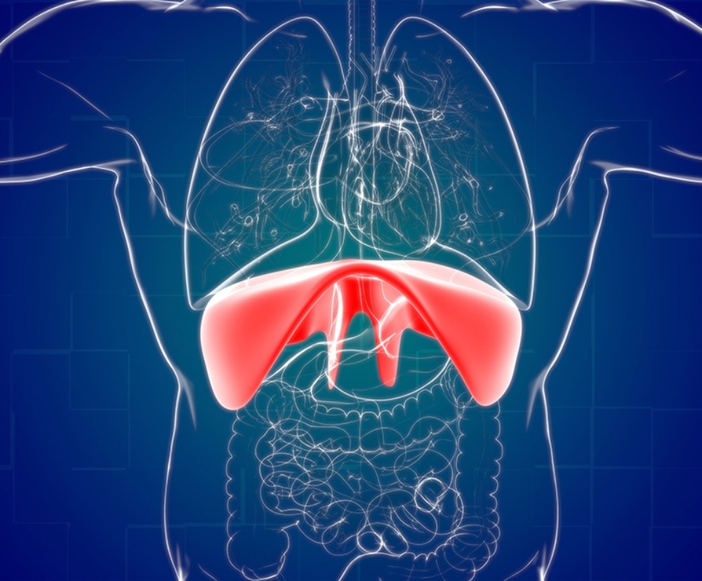 HHG - Διαφραγματοκήλη HHG - Διαφραγματοκήλη