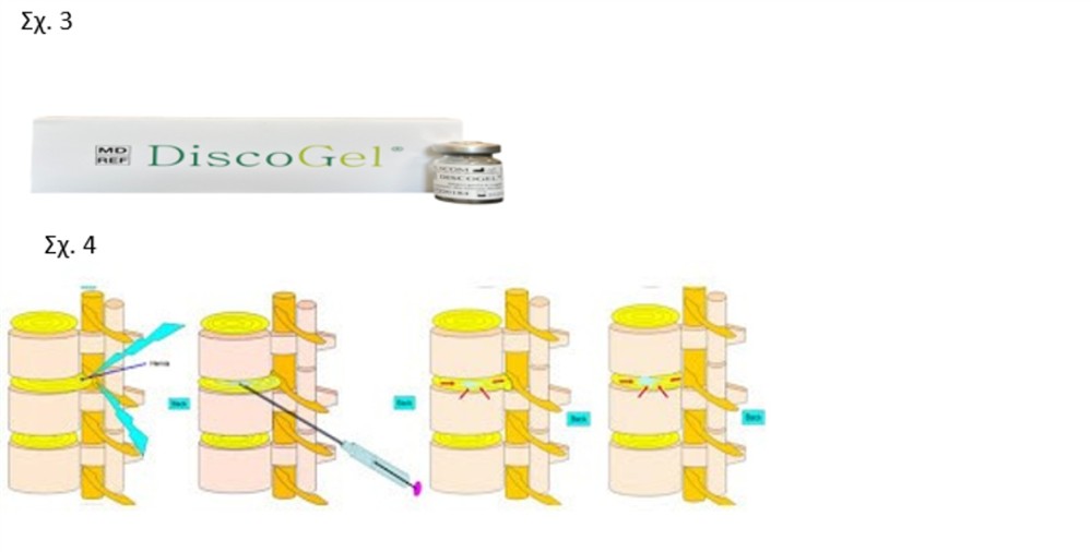 HHG - ΔΡΥΜΟΥΣΗΣ ΜΕΛΕΤΙΟΣ HHG - ΔΡΥΜΟΥΣΗΣ ΜΕΛΕΤΙΟΣ