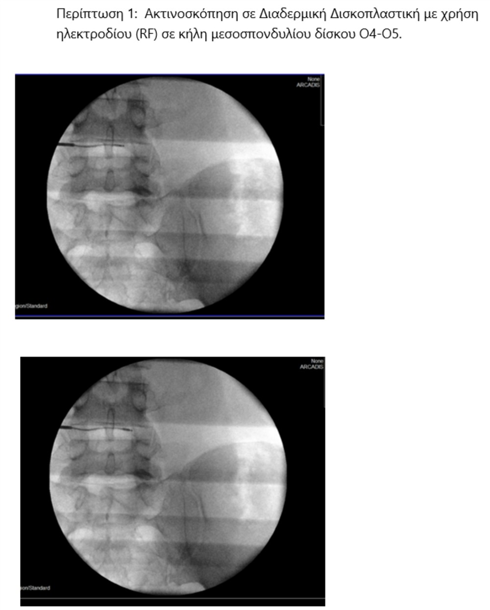 HHG - ΔΡΥΜΟΥΣΗΣ ΜΕΛΕΤΙΟΣ HHG - ΔΡΥΜΟΥΣΗΣ ΜΕΛΕΤΙΟΣ