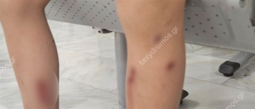 Βόλος - 7χρονος - Αδέσποτα Βόλος - 7χρονος - Αδέσποτα