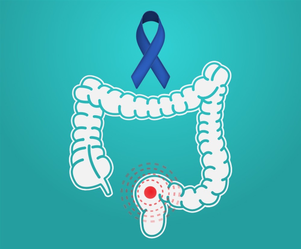 HHG - Λιάκος HHG - Λιάκος