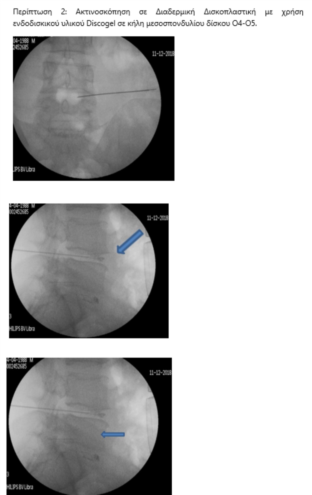 HHG - ΔΡΥΜΟΥΣΗΣ ΜΕΛΕΤΙΟΣ HHG - ΔΡΥΜΟΥΣΗΣ ΜΕΛΕΤΙΟΣ