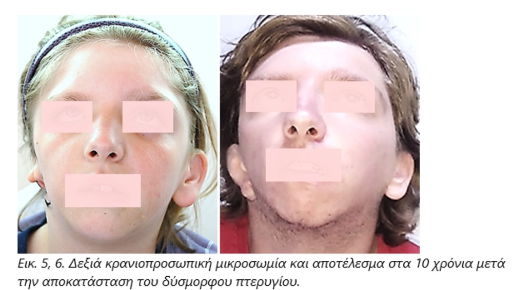 HHG - ΚΑΞΙΡΑ HHG - ΚΑΞΙΡΑ