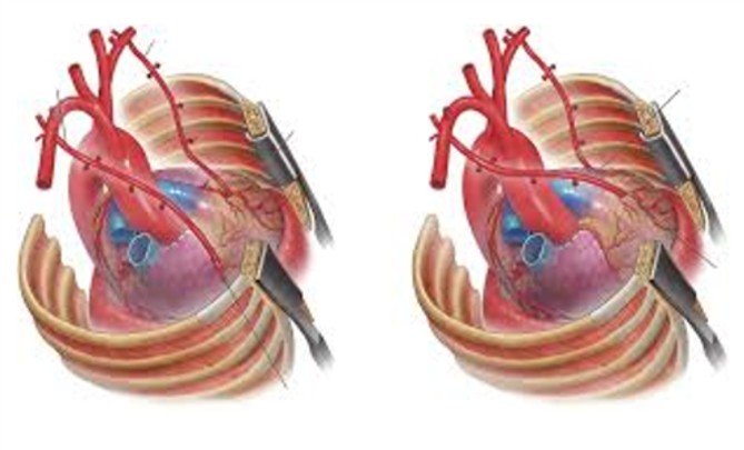 Metropolitan - Ηλιόπουλος Metropolitan - Ηλιόπουλος